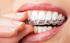 RXaligners